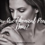 How Are Chemical Peels Done?